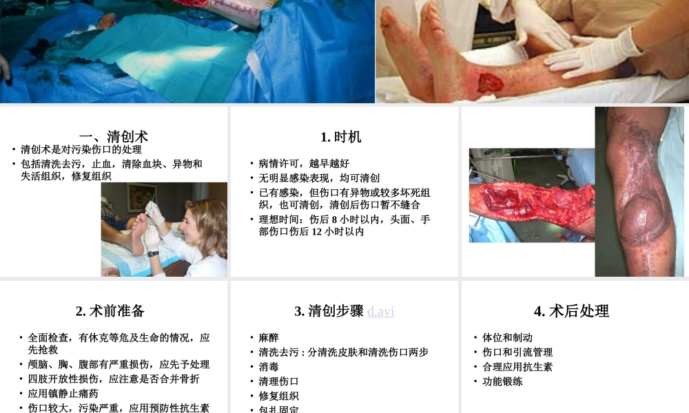 清创术与换药术.ppt