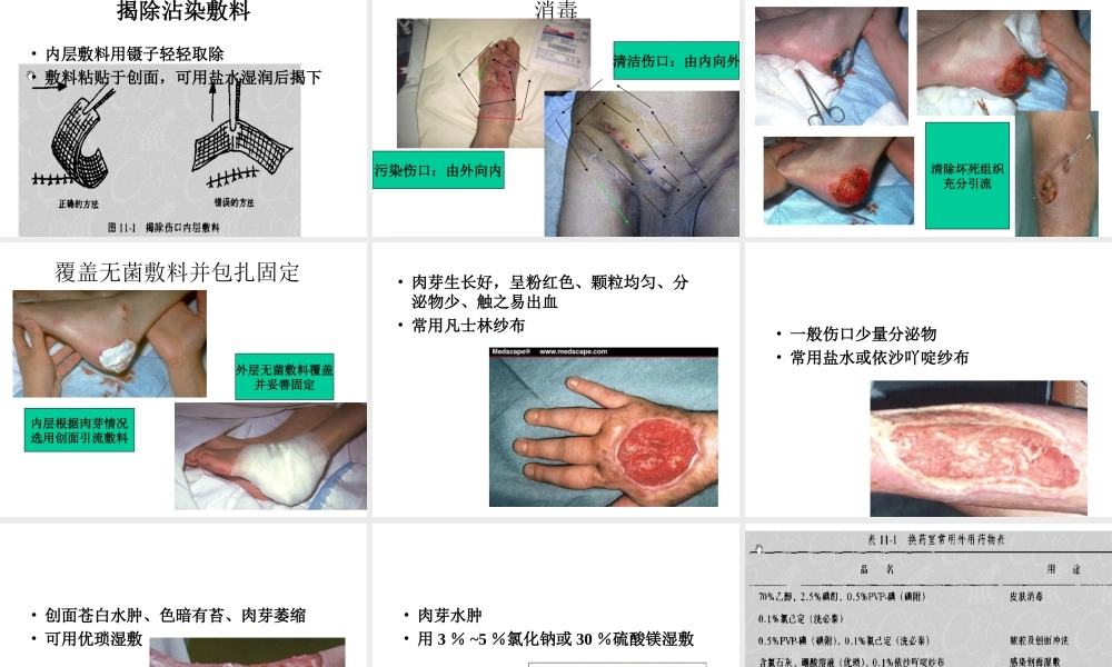 清创术与换药术.ppt