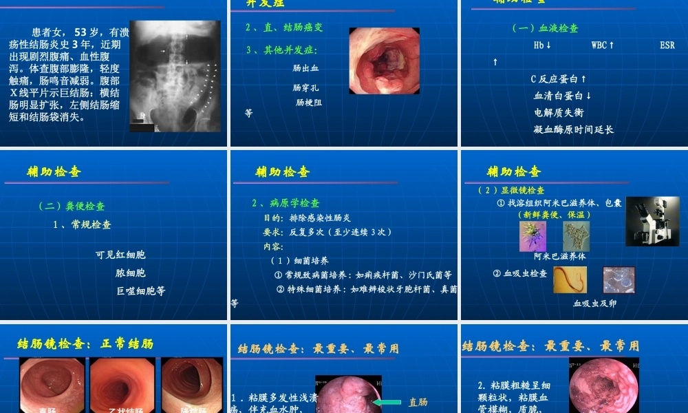 溃疡性结肠炎.ppt