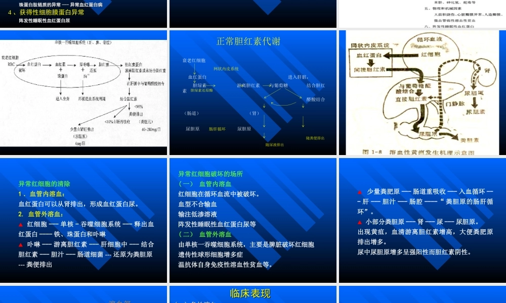 溶血性贫血讲稿.ppt
