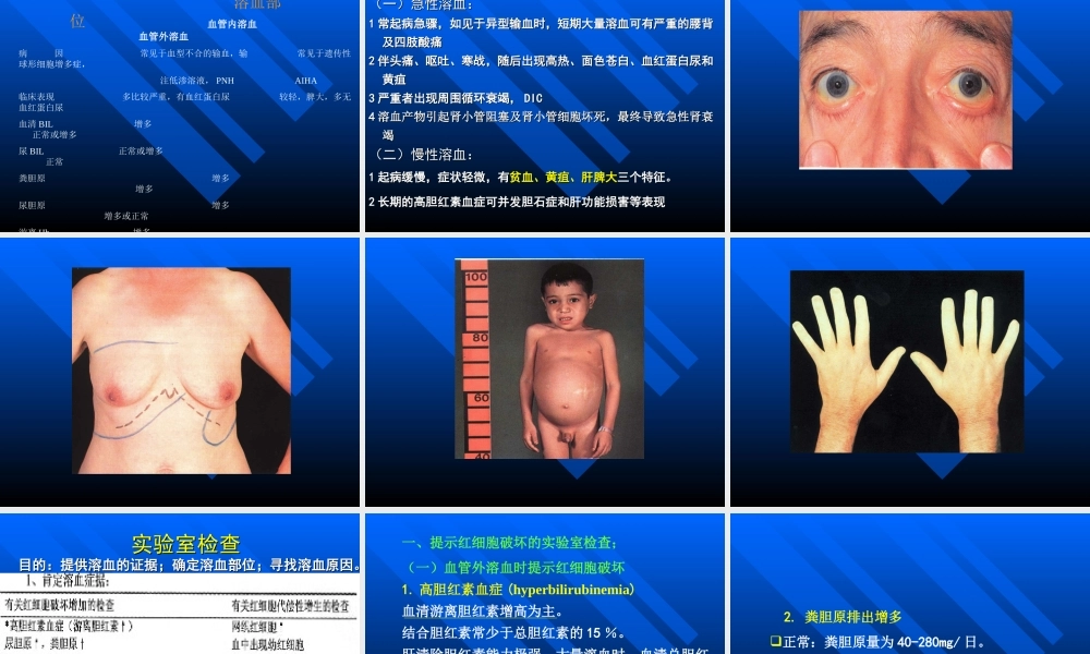 溶血性贫血讲稿.ppt