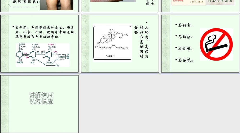 滑膜炎用药指导浅论.ppt