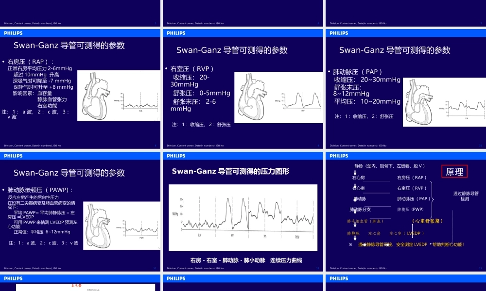 漂浮导管及血流动力学监测..ppt