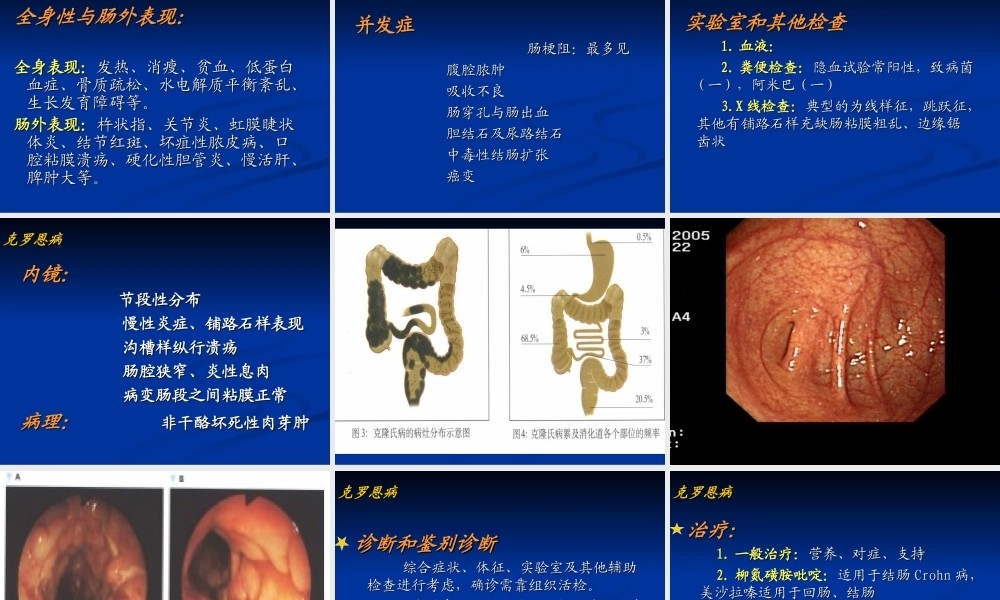 炎症性肠病--可罗恩病2013.ppt