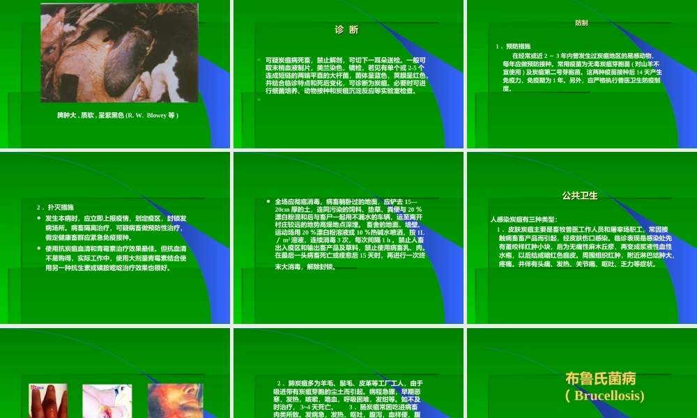 炭疽、布氏杆菌病.ppt