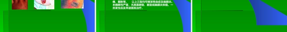 炭疽、布氏杆菌病.ppt