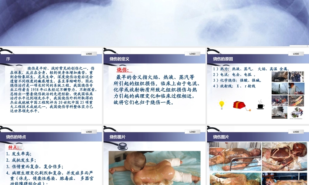 烧伤学基础知识.ppt