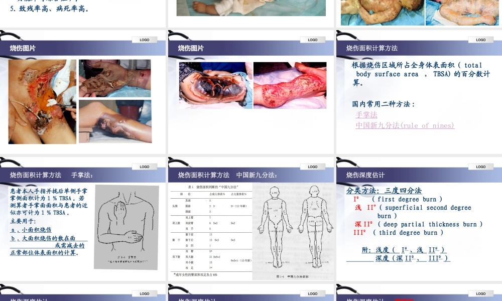 烧伤学基础知识.ppt
