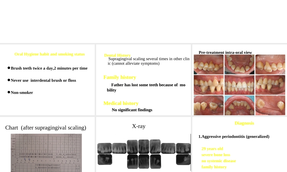 牙-周-病-学-第四版-8.ppt