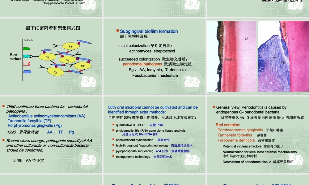 牙周病与免疫.ppt