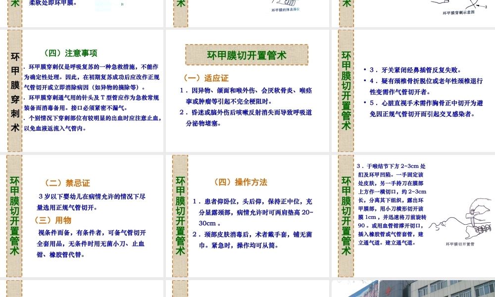 环甲膜穿刺切开术.ppt