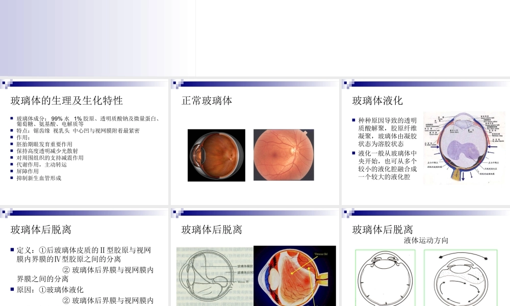玻璃体液化及玻璃体积血概要.ppt