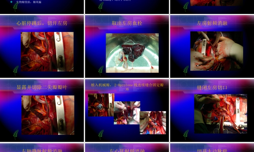 瓣膜替换术的术中配合.ppt