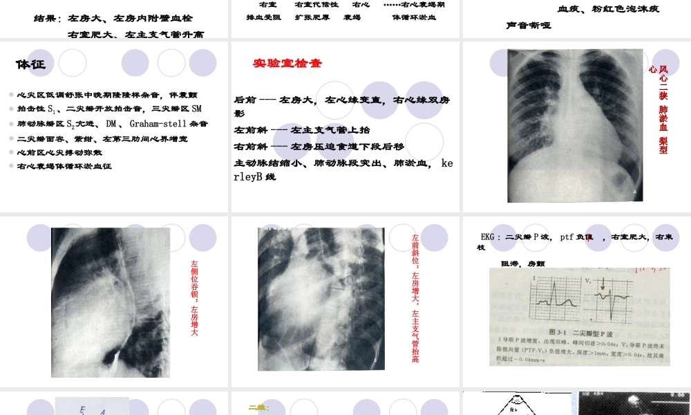 瓣膜病zhihong.ppt