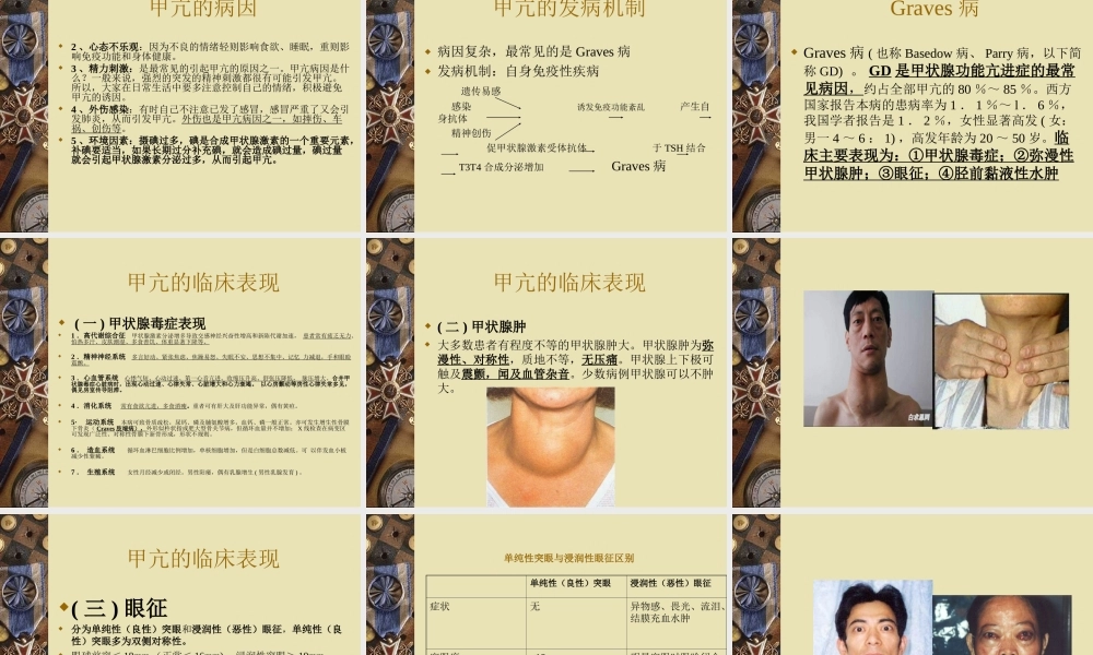 甲亢性心脏病-李婷婷.ppt