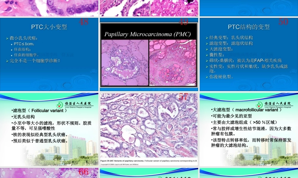 甲状腺乳头状癌-ppt-(1).ppt