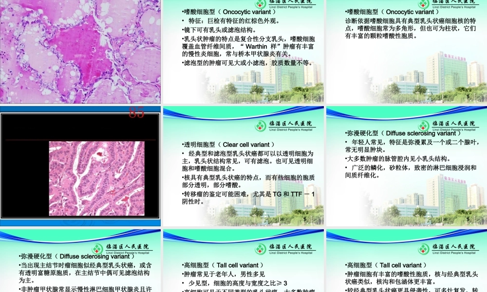 甲状腺乳头状癌-ppt-(1).ppt
