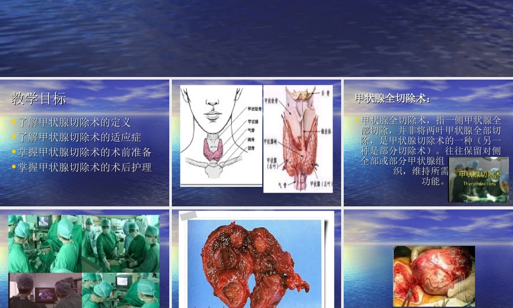 甲状腺全切除术.ppt