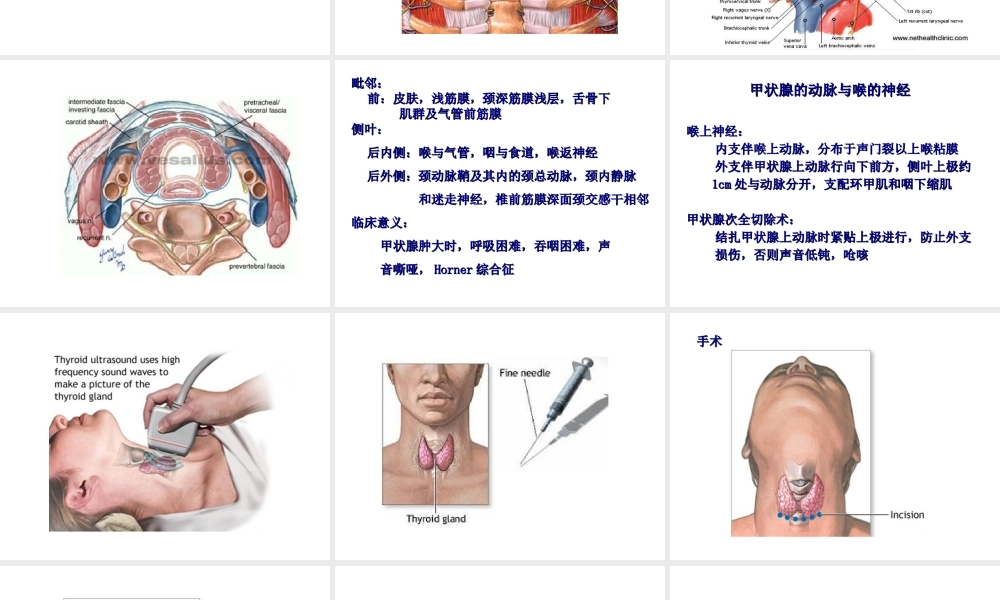 甲状腺切除术.ppt.ppt