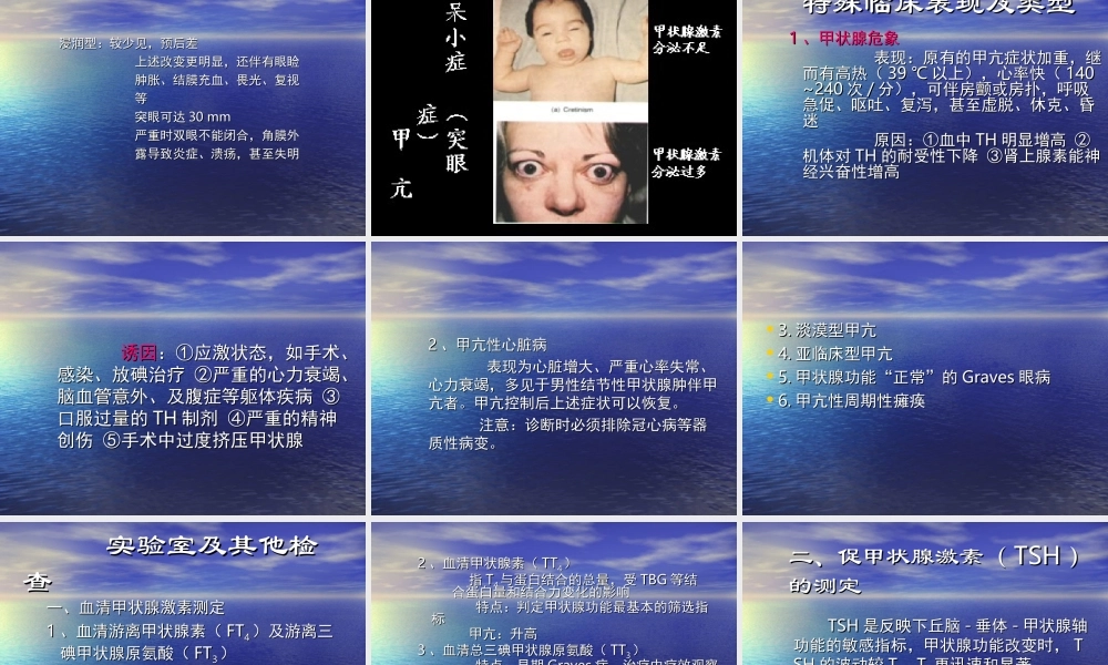 甲状腺功能亢进症(1).ppt