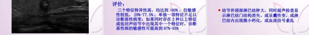 甲状腺指南结节.ppt