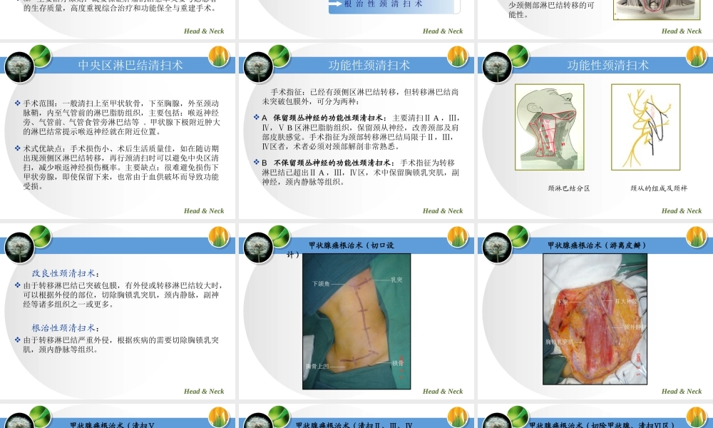 甲状腺癌的颈部淋巴结清扫原则.ppt