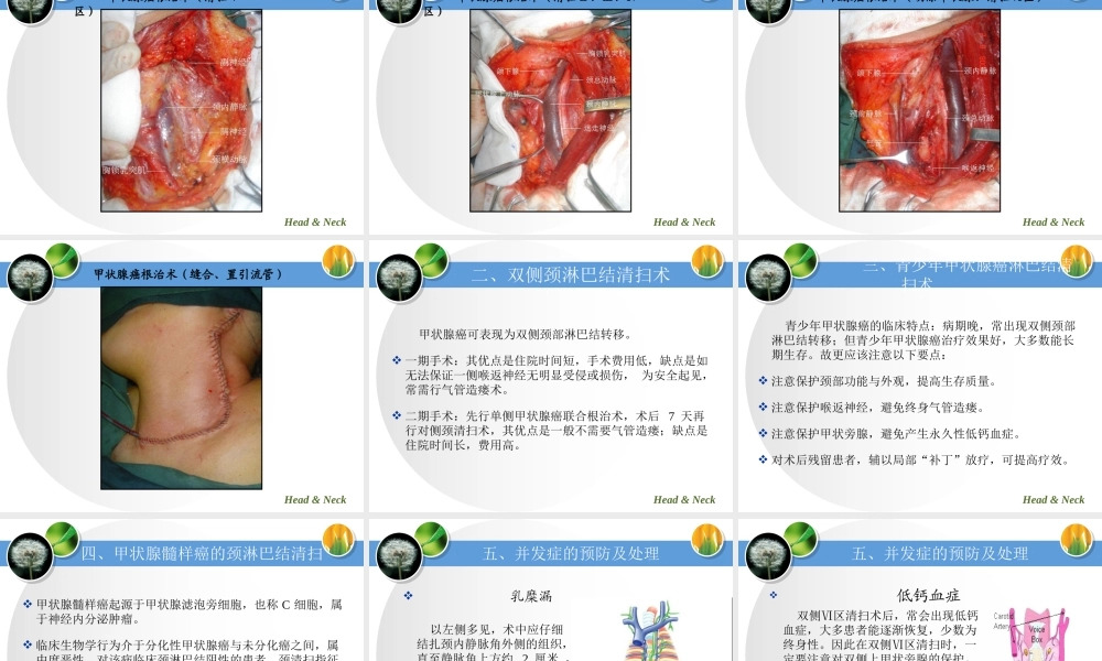 甲状腺癌的颈部淋巴结清扫原则.ppt