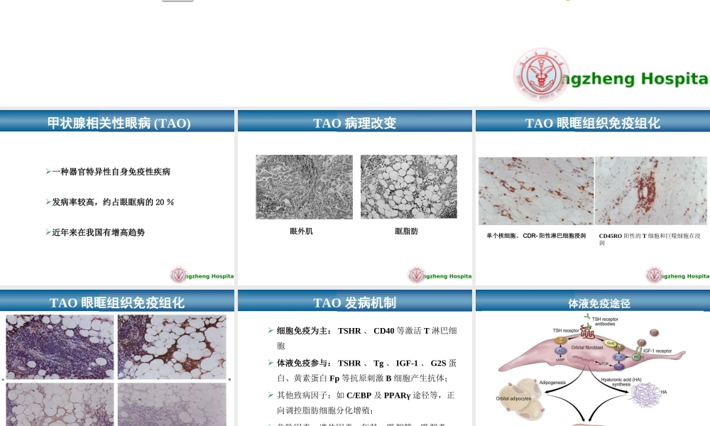 甲状腺相关性眼病新进展最终.ppt