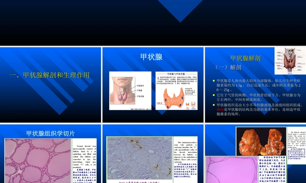 甲状腺结节(内训资料).ppt