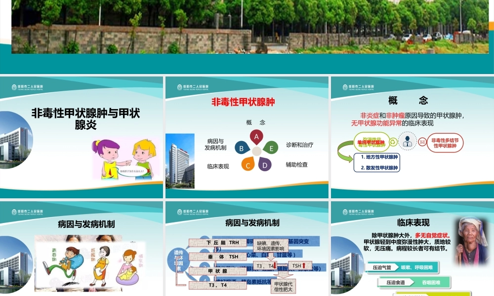 甲状腺肿与甲状腺炎.pptx