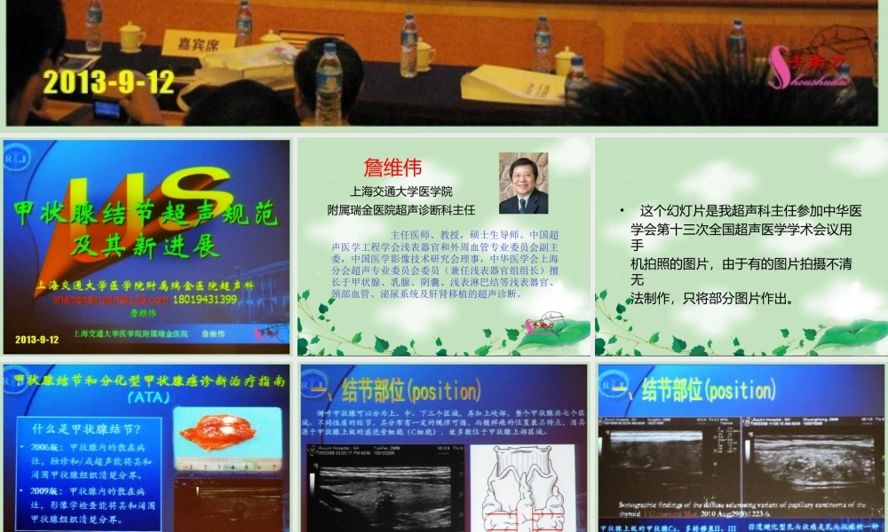 甲状腺结节超声规范及其新进展.ppt