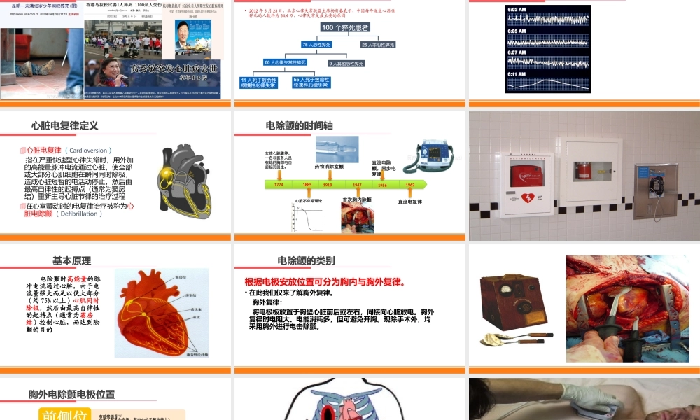 电复律与临时心脏起搏技术.pptx