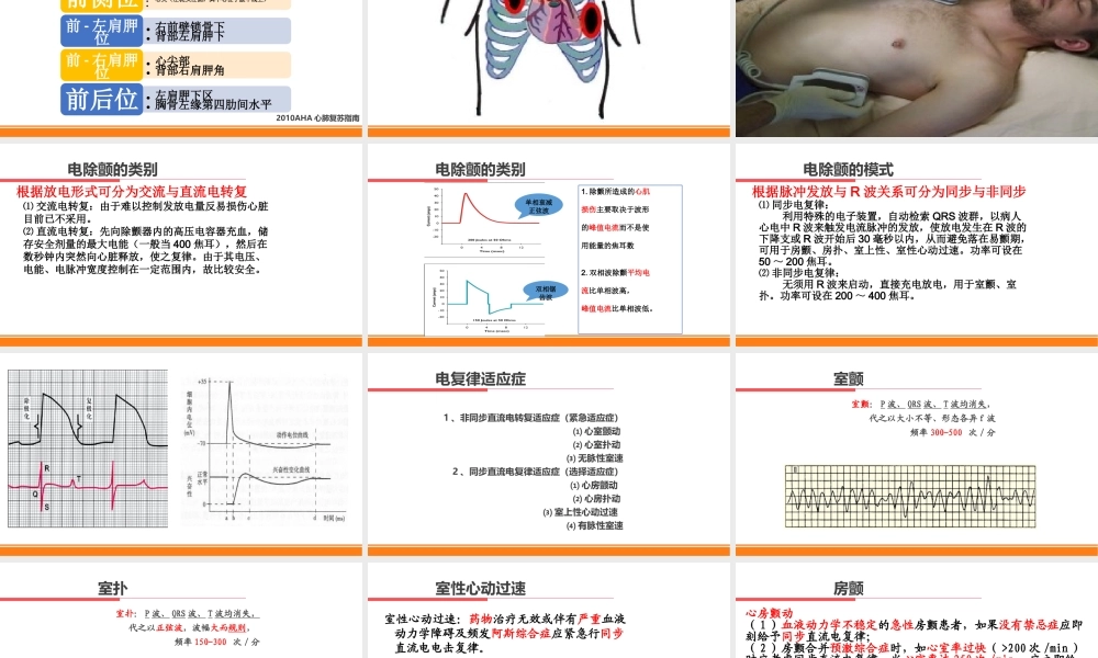 电复律与临时心脏起搏技术.pptx