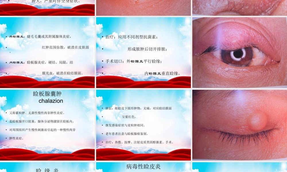 眼--睑-病.ppt