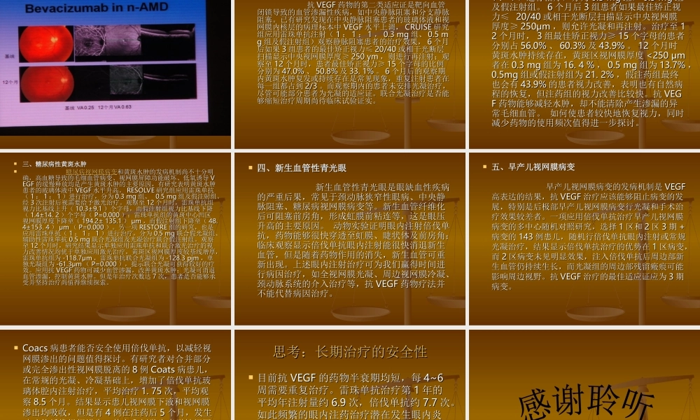 眼内抗血管生成药.ppt