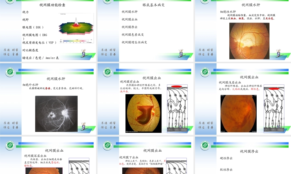 眼底病与全身病.ppt
