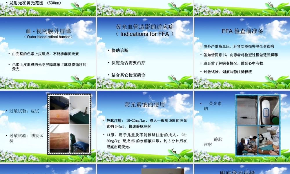 眼底荧光血管造影-陈娟.ppt