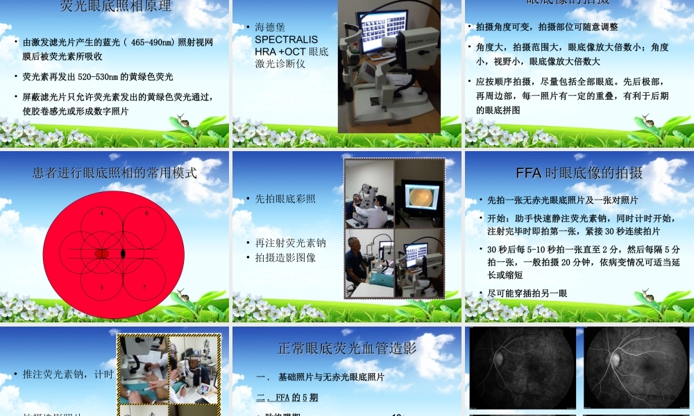 眼底荧光血管造影-陈娟.ppt