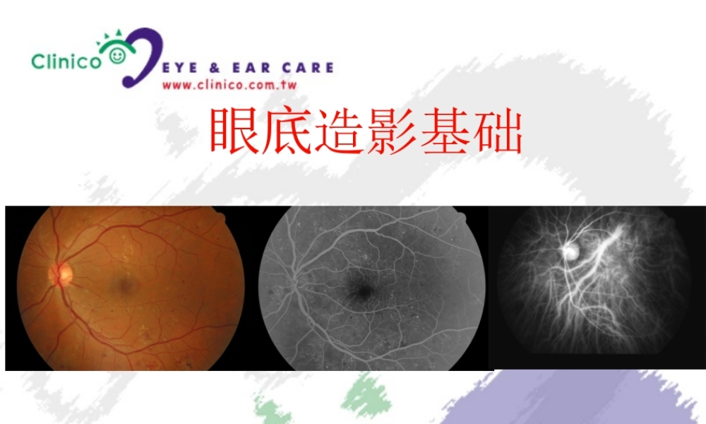 眼底造影基础.ppt