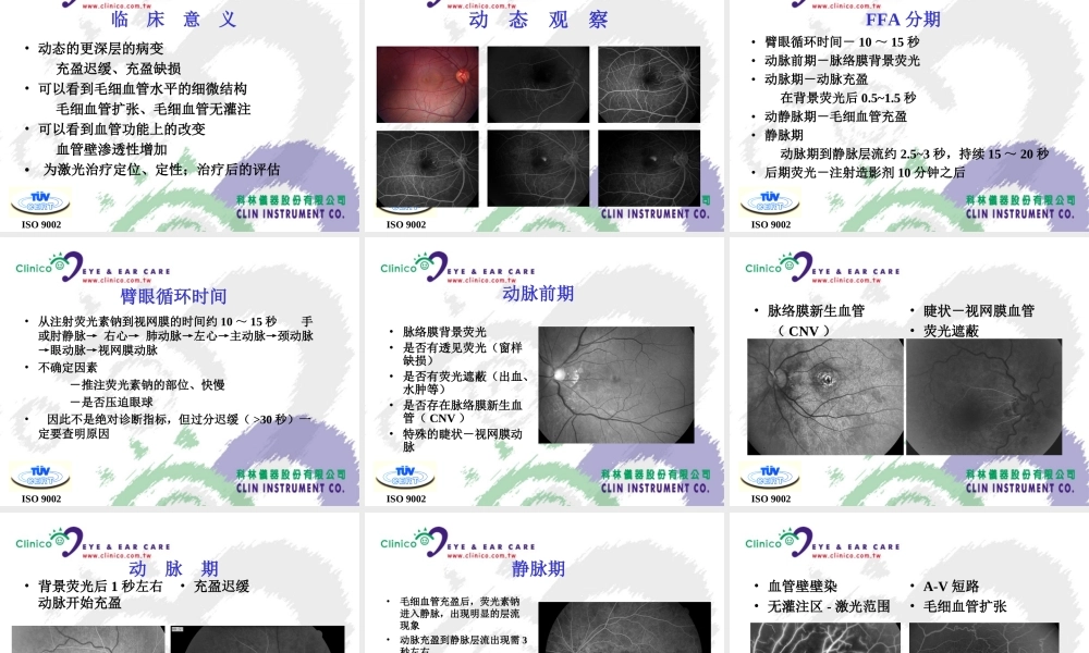 眼底造影基础.ppt