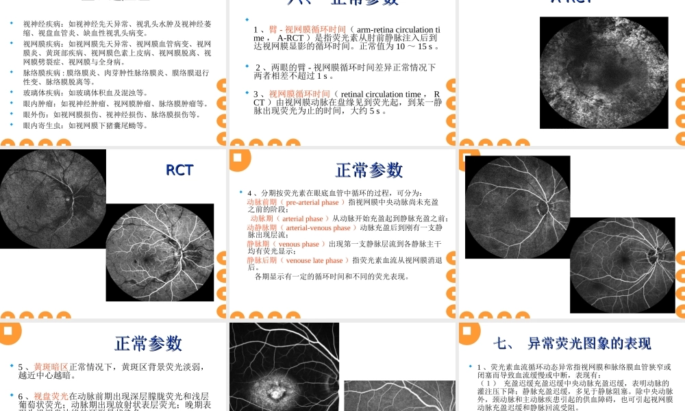 眼底血管造影.ppt