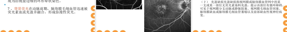 眼底血管造影.ppt