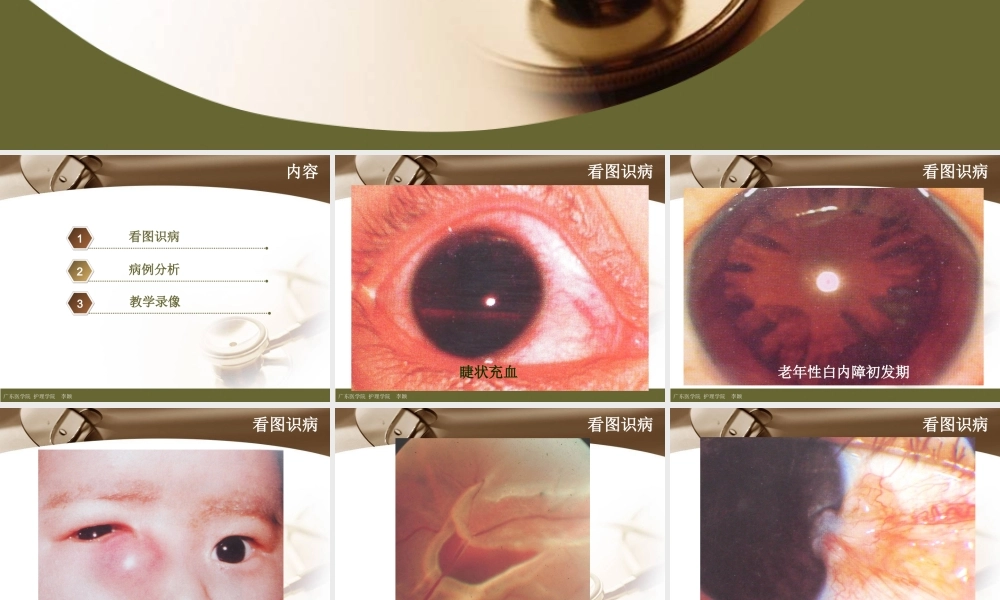 眼科病例讨论.ppt