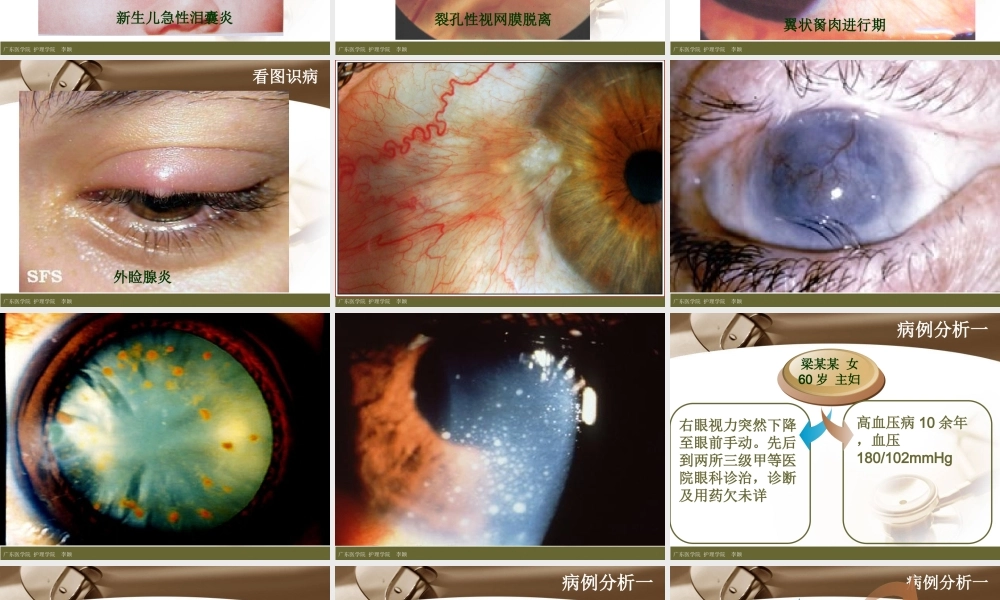 眼科病例讨论.ppt