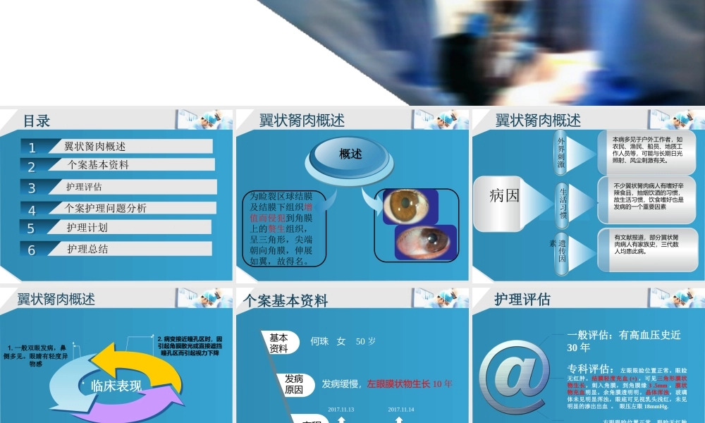 眼科翼状胬肉.pptx