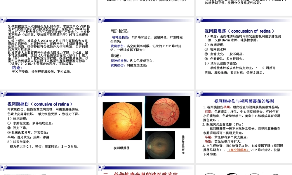 眼耳损伤的鉴定难点.ppt