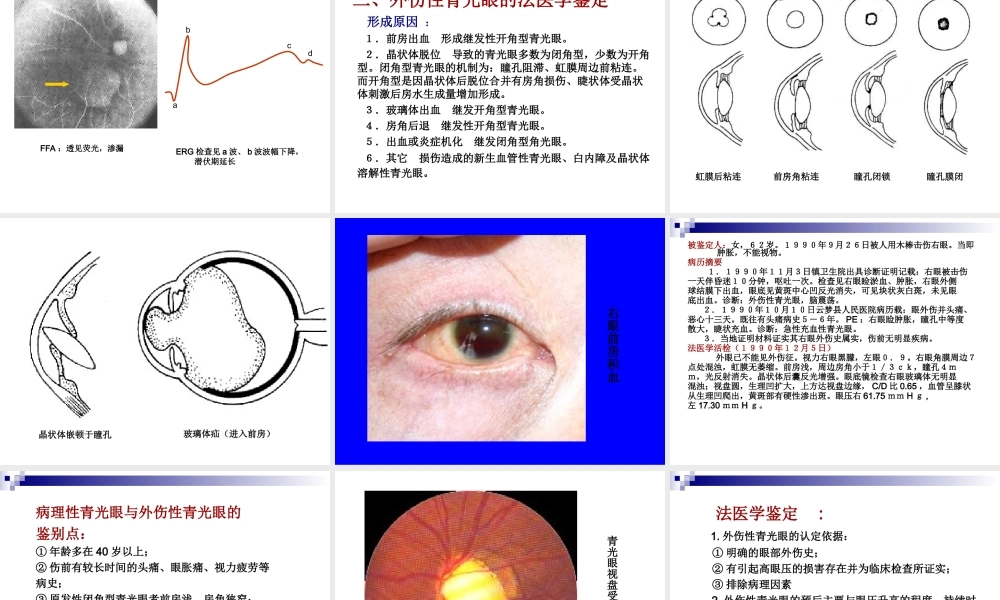 眼耳损伤的鉴定难点.ppt