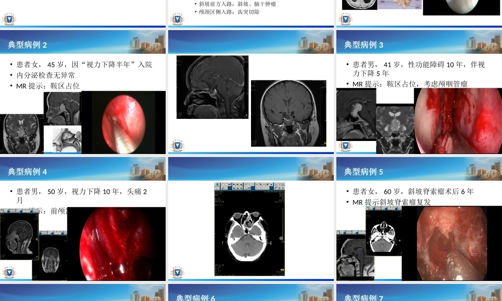 神经内镜应用体会.ppt