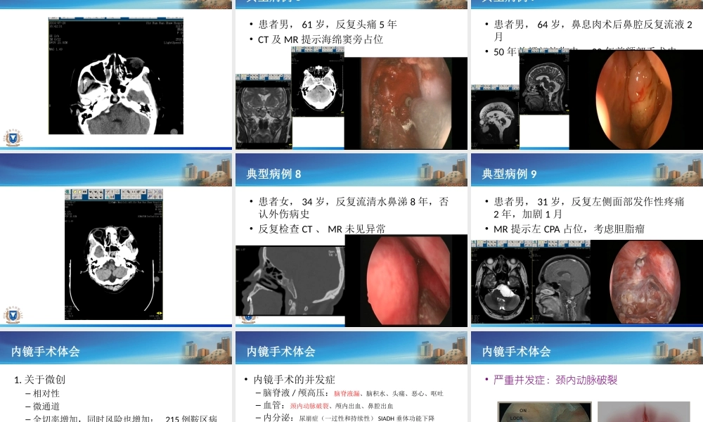 神经内镜应用体会.ppt
