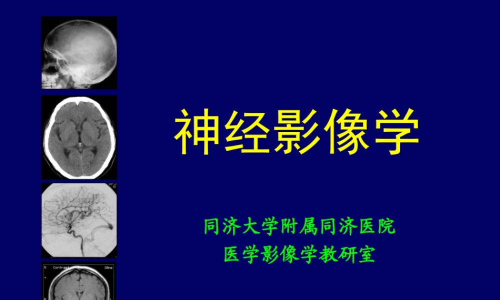神经影像学--颅脑检查方法[1].ppt